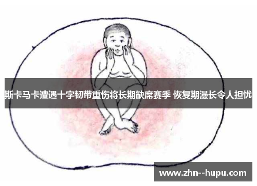 斯卡马卡遭遇十字韧带重伤将长期缺席赛季 恢复期漫长令人担忧